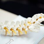 perbedaan osteoporosis dan osteoarthritis