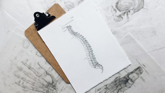 mengenal osteoporosis dan osteoarthritis
